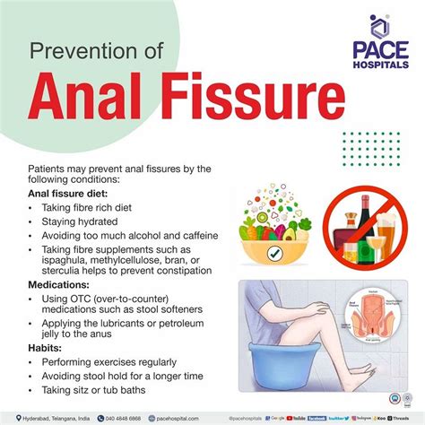 Anal Fissure Prevention