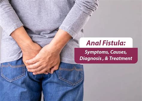 Anal Pain Symptoms