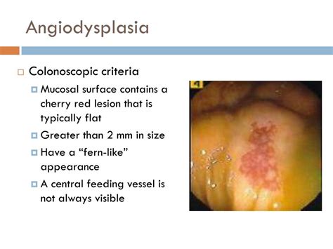 angiodysplasia identification