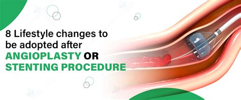 Angioplasty and Lifestyle Changes