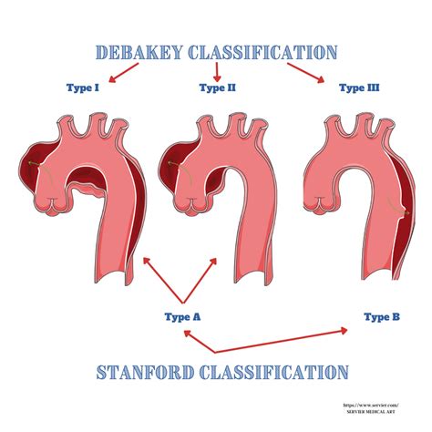 aortic education