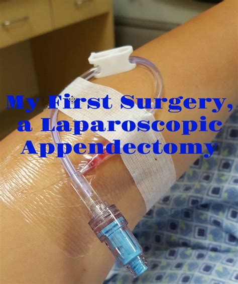appendectomy preparation