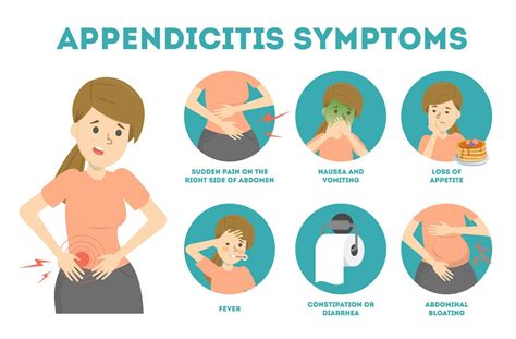 appendicitis symptoms illustration
