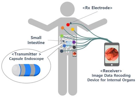 applications of capsule endoscopy camera