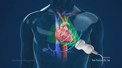 Applications of Cardioechogram