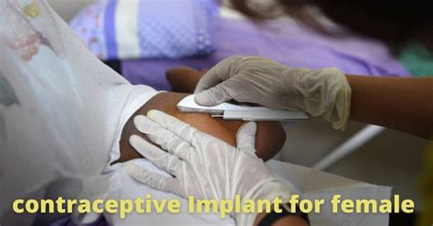 arm birth control implant