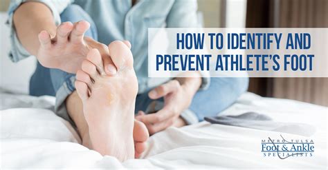 Athlete's foot prevention