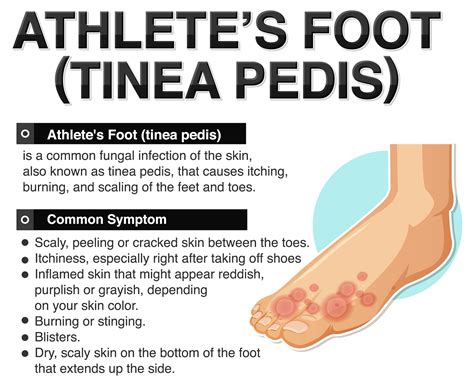 Athlete's foot symptoms