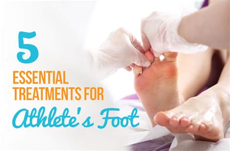 Athlete's foot treatment