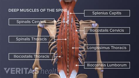 back muscle pain
