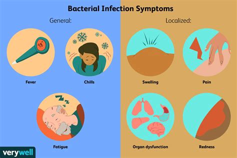 Bacterial Infections