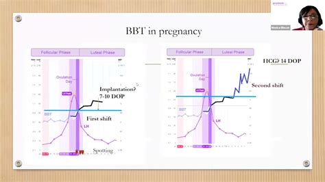 BBT tracking