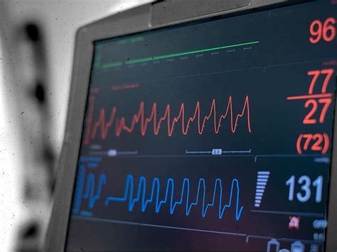 Benefits and Risks of Intra-Aortic Balloon Pump Therapy