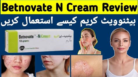 Benefits of Betamethasone Cream