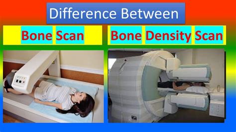 benefits of bone scans