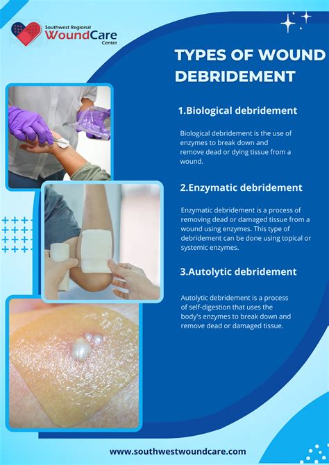 Benefits of debridement