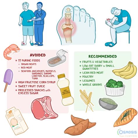 Benefits of a Gout Diet