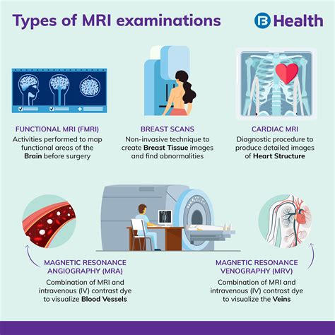 Benefits of Head MRI Test