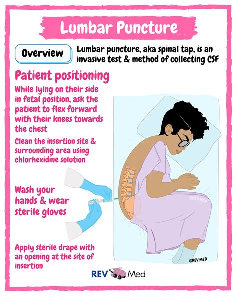 Benefits of Lumbar Puncture Procedure