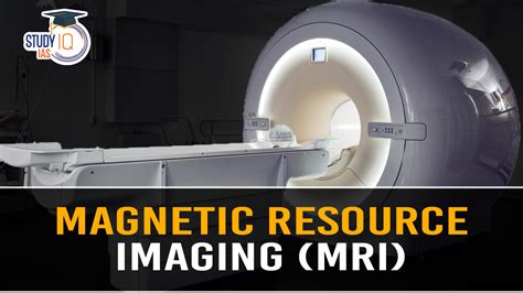Benefits of MRI Scan