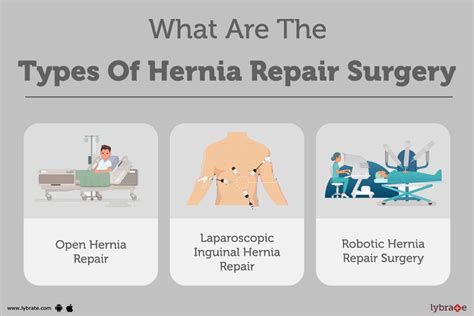 Benefits of Umbilical Hernioplasty