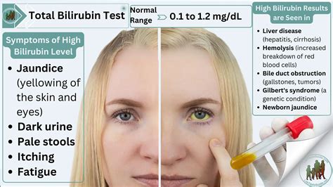 Bilirubin Test