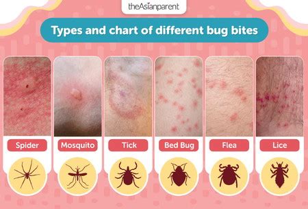 Bite and Sting Types