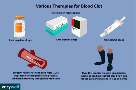 blood clot treatment