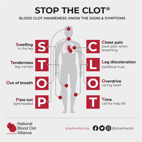 Blood Clots Formation