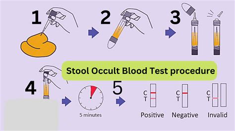 blood feces test procedure