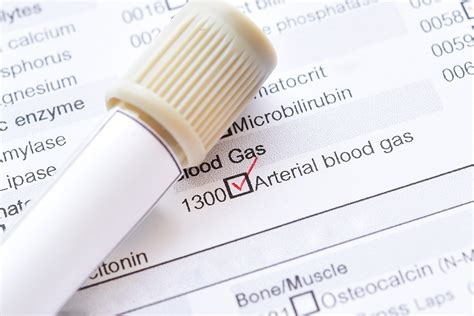 Blood Test