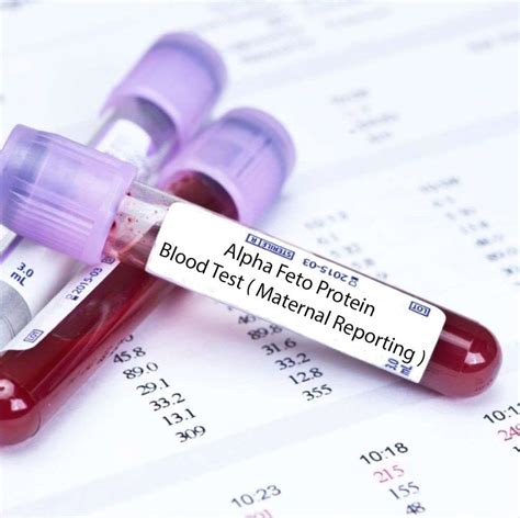 Blood Test Image