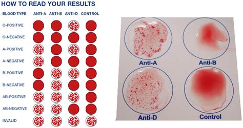 Blood Type Testing