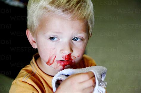 bloody nose in children