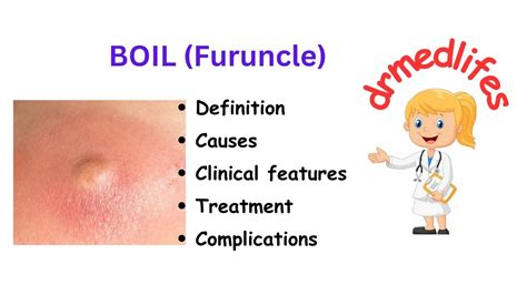 Boil Complications