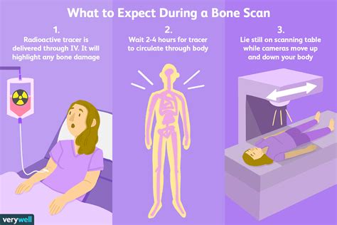 bone scan procedure steps