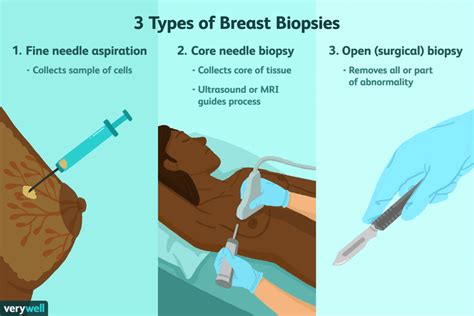 Breast Cancer Biopsy Preparation