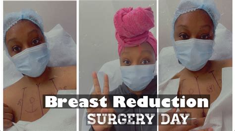 breast reduction and lift surgery