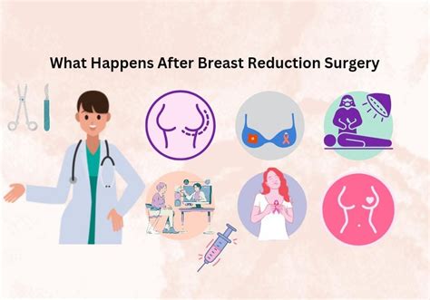 breast reduction procedure