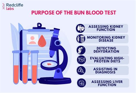 Bun Test Overview
