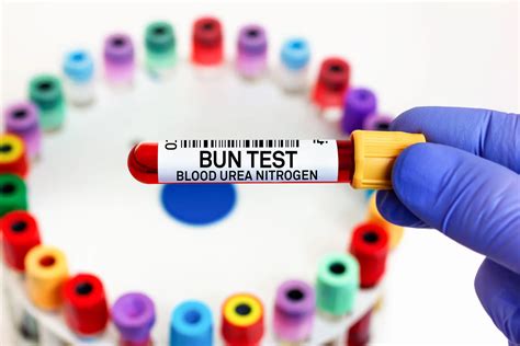 Bun Test vs. Other Kidney Function Tests