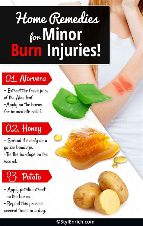 burn relief remedies