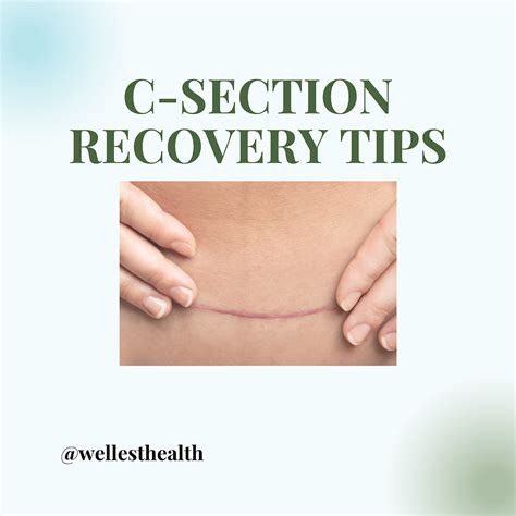 C-section recovery overview