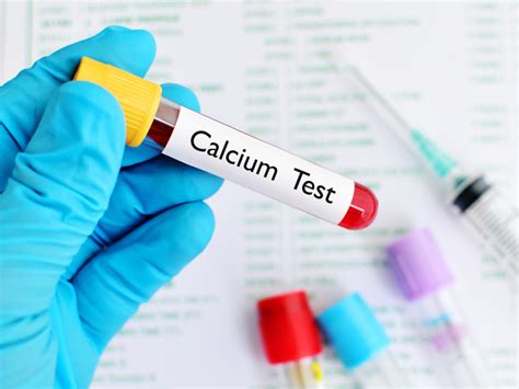 Calcium test and medical conditions