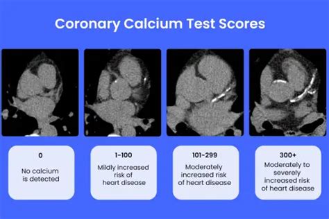 Interpreting calcium test results