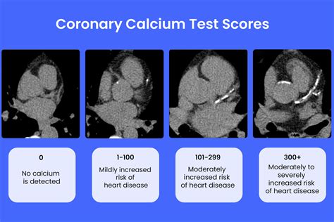 Calcium test working mechanism