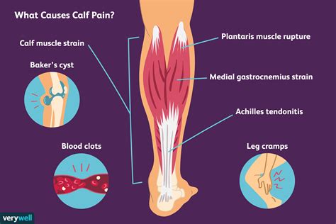 calf muscle pull causes