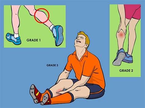 calf muscle pull prevention strategies