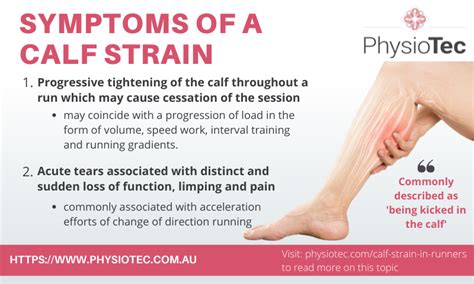 calf muscle pull symptoms