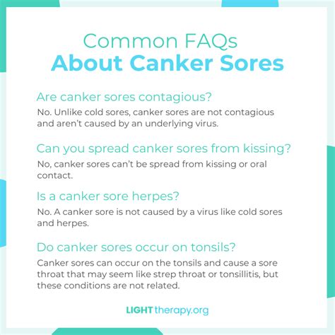 Canker sore FAQs
